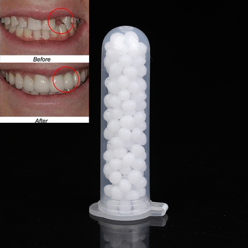 【K】1Box Temporary Tooth Repair - Teeth Whitening Kit 评论和价格