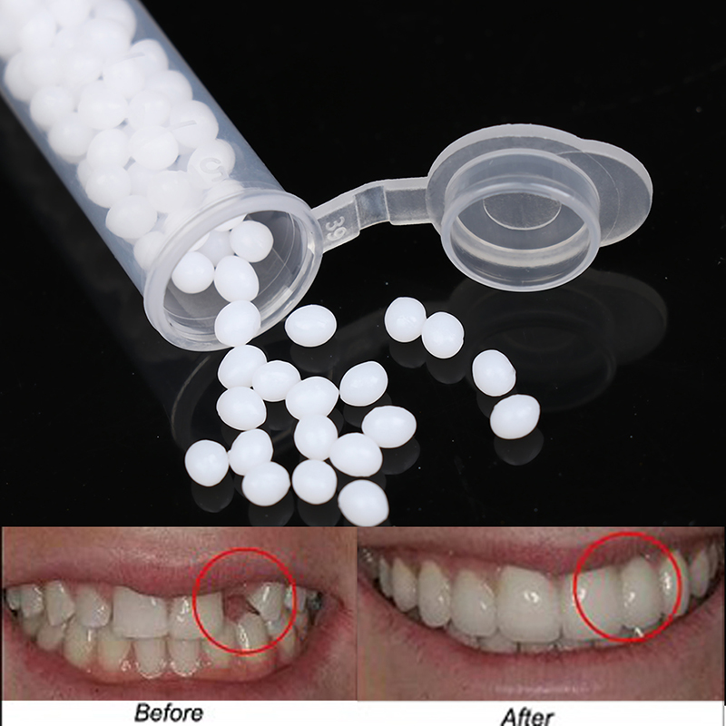 【K】1Box Temporary Tooth Repair - Teeth Whitening Kit 评论和价格